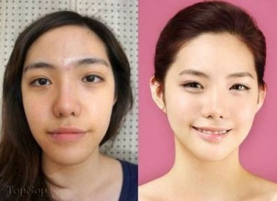 قبل و بعد از جراحی زیبایی در کره ی جنوبی 1