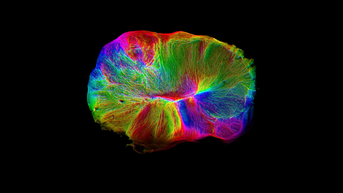 رشد یک مغز کوچک در آزمایشگاه 