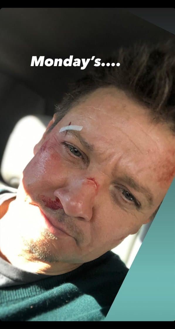 جرمی رنر تصویری از صورت آسیب دیده خود از پشت صحنه سریال Hawkeye را منتشر کرد 1
